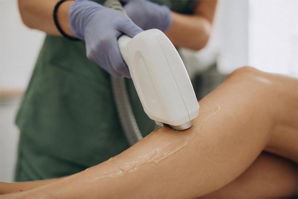 ¿Cómo cuidar la piel después de una depilación para evitar irritaciones y granitos?