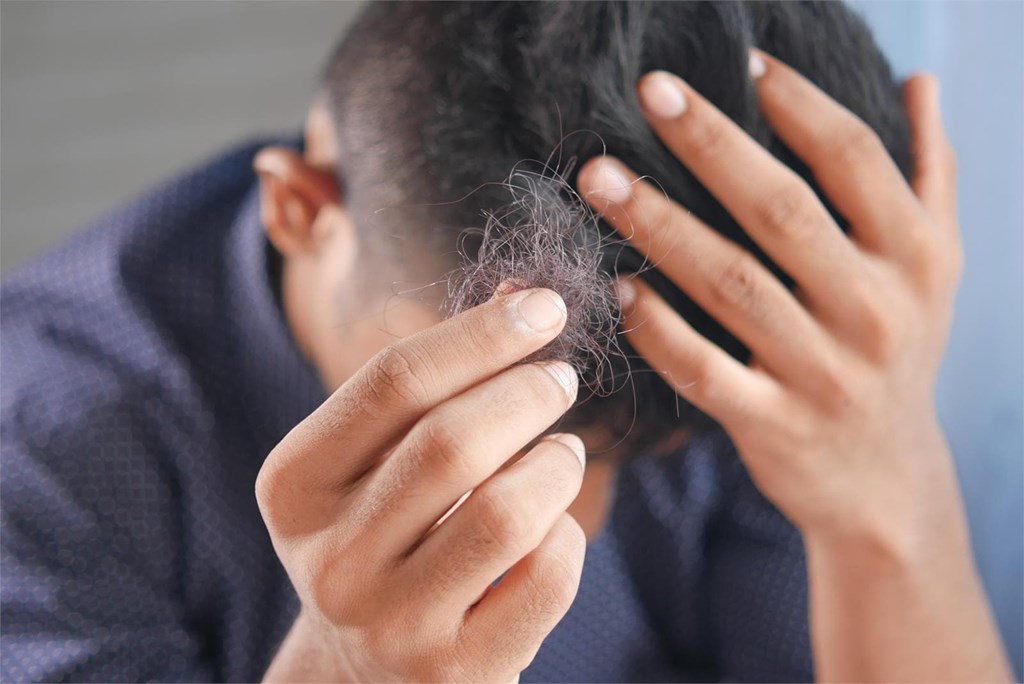 Tratamientos para impedir la caída de cabello