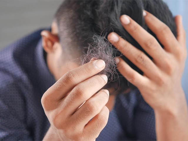 Tratamientos para impedir la caída de cabello